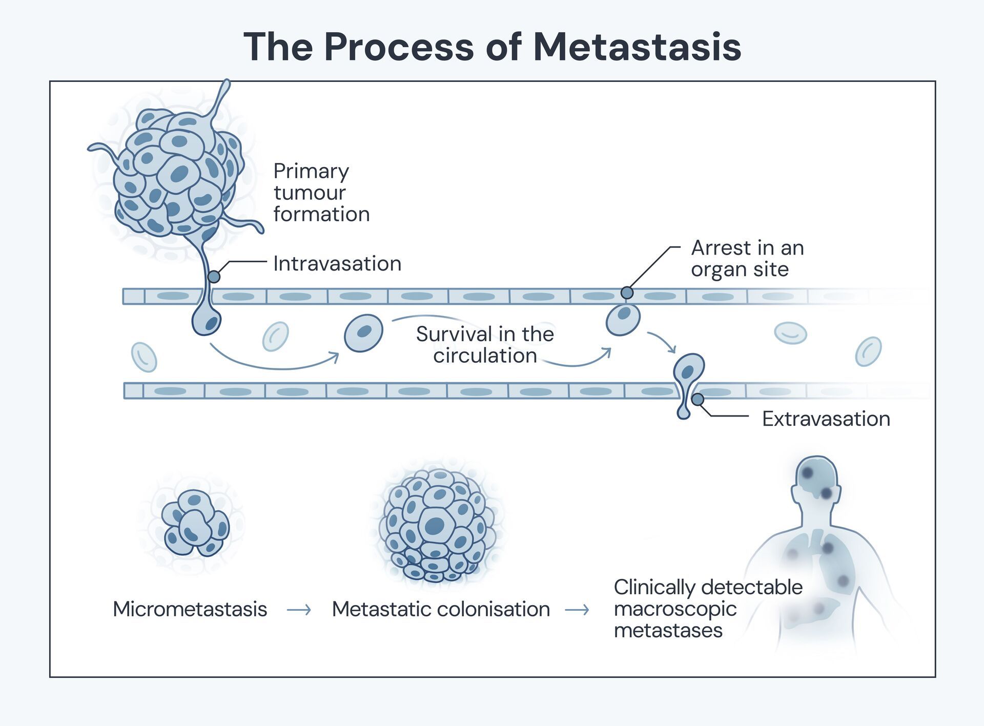 The Process of Metastatic