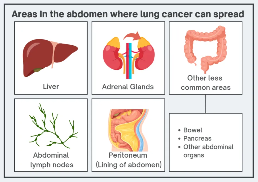 Areas in the abdomen where lung cancer can spread