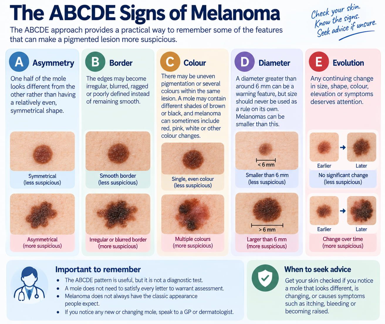 The ABCDE Signs of Melanoma
