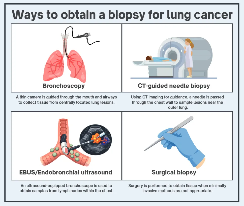 Ways to obtain a biopsy for lung cancer