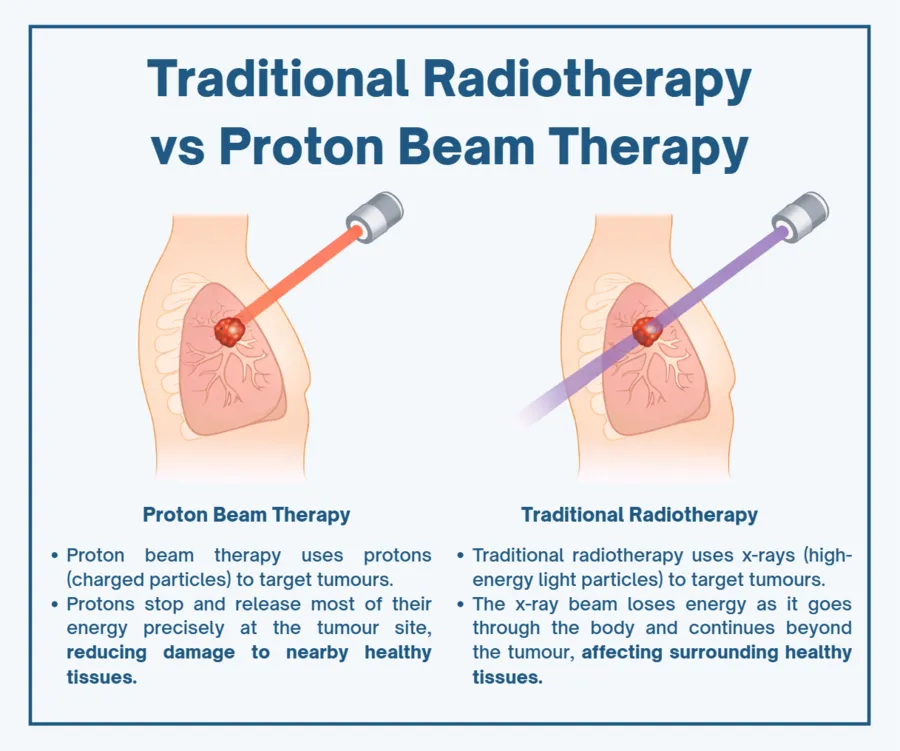 Traditional Radiotherapy vs Proton Beam Therapy