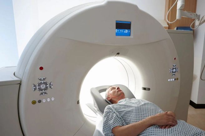 Importance of Early Detection of Non-Small Cell Lung Cancer