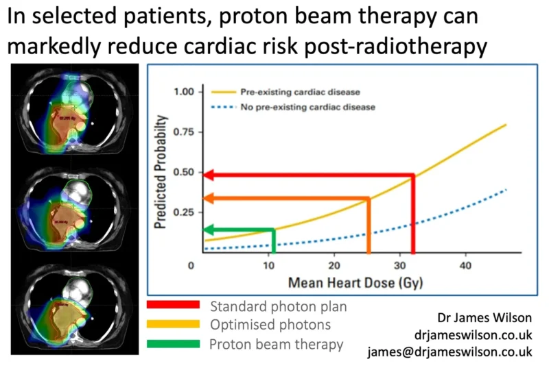 Proton beam therapy for lung cancer