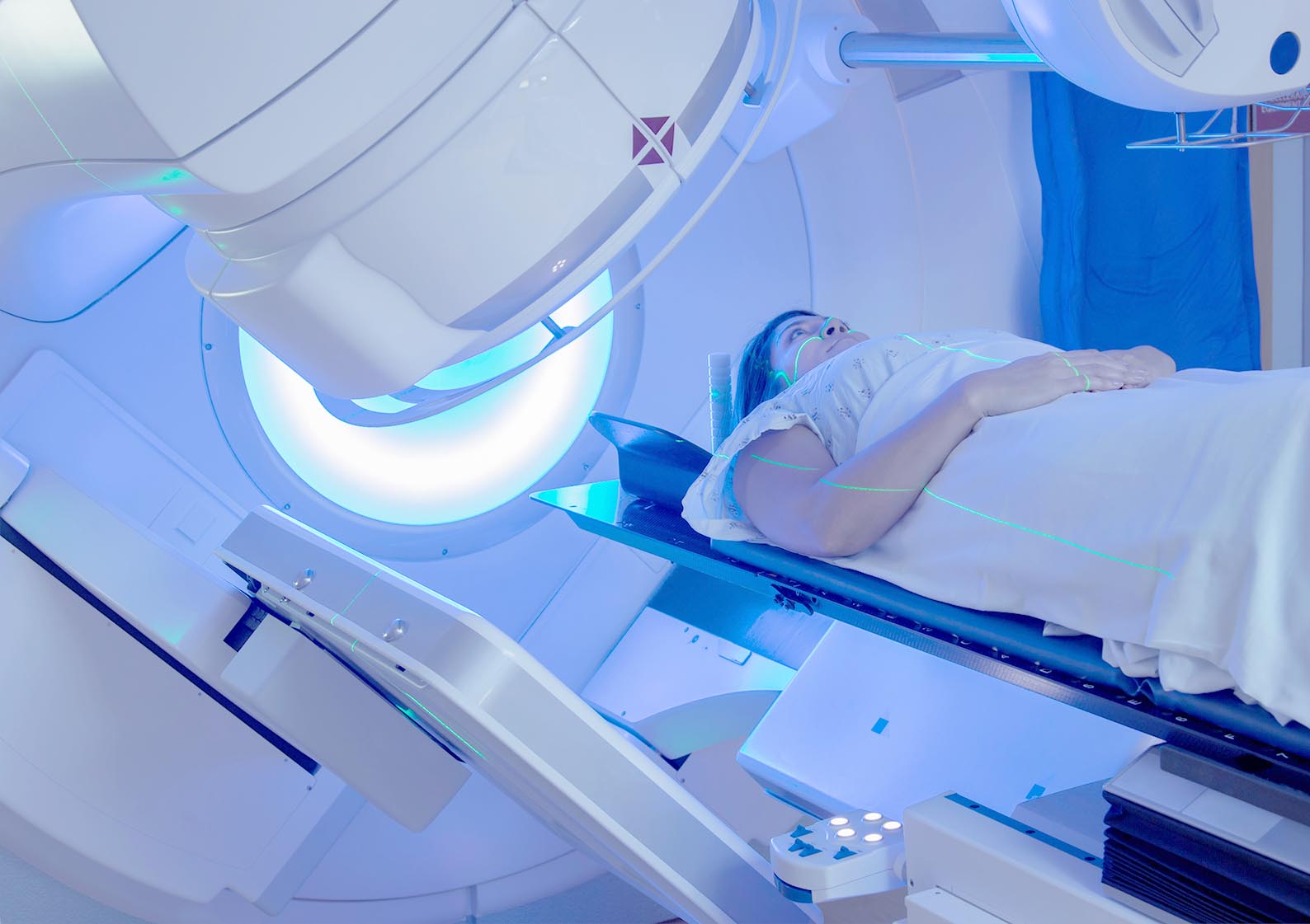 Stereotactic Radiotherapy